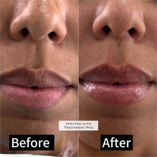 before and after treatment photo